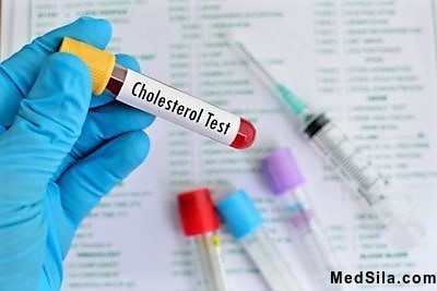 Определение холестерина